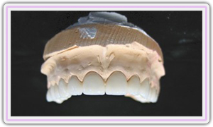 Cad Cam Milled Zirconia Crowns For Highest And Best Precision Fit