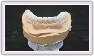 Cad Cam Milled Zirconia Lower Crowns