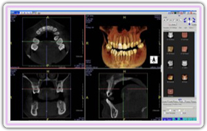 512 Slices Scanner For Accuracy And Better Diagnosis