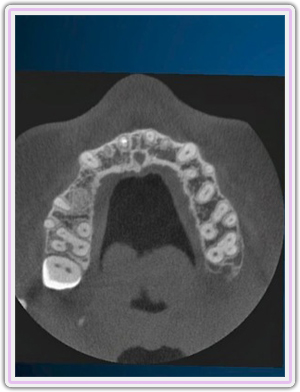 Ct Scan Imaging